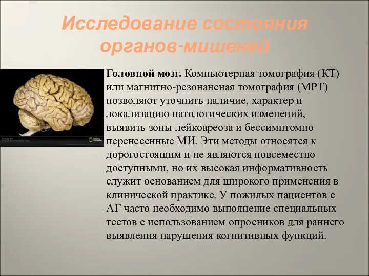 Исследование состояния органов-мишеней Головной мозг. Компьютерная томография (КТ) или магнитно-резонансная