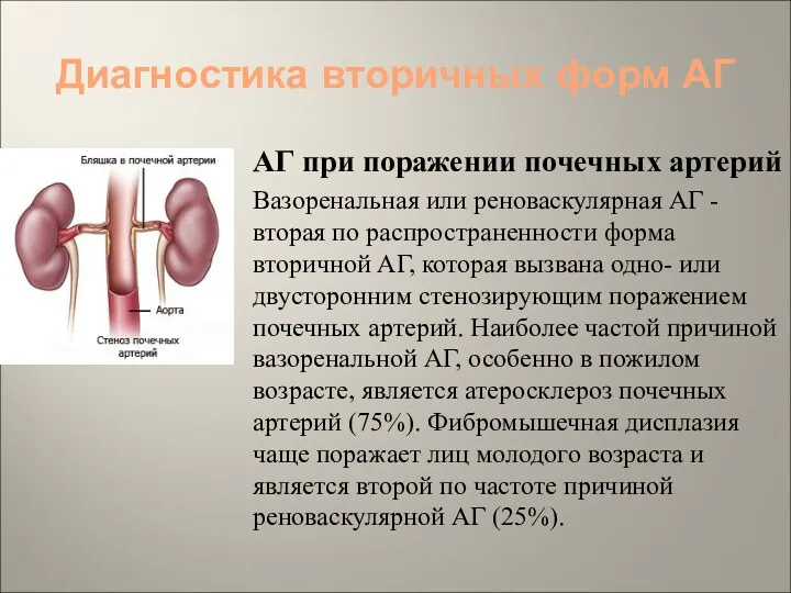 Диагностика вторичных форм АГ АГ при поражении почечных артерий Вазоренальная или реноваскулярная АГ