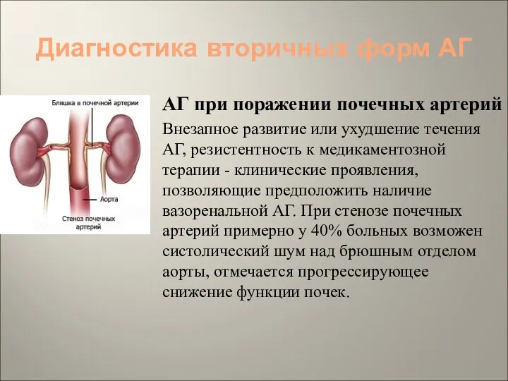 Диагностика вторичных форм АГ АГ при поражении почечных артерий Внезапное развитие или ухудшение