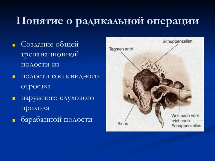 Понятие о радикальной операции Создание общей трепанационной полости из полости