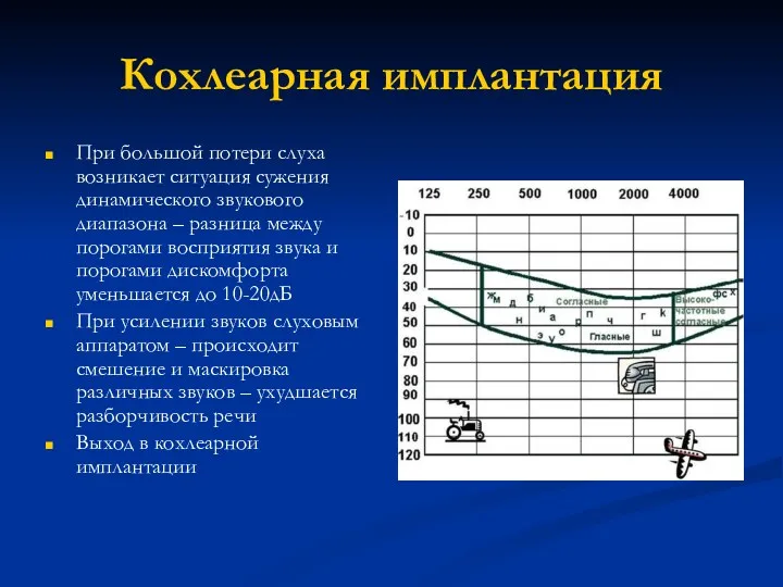 Кохлеарная имплантация При большой потери слуха возникает ситуация сужения динамического