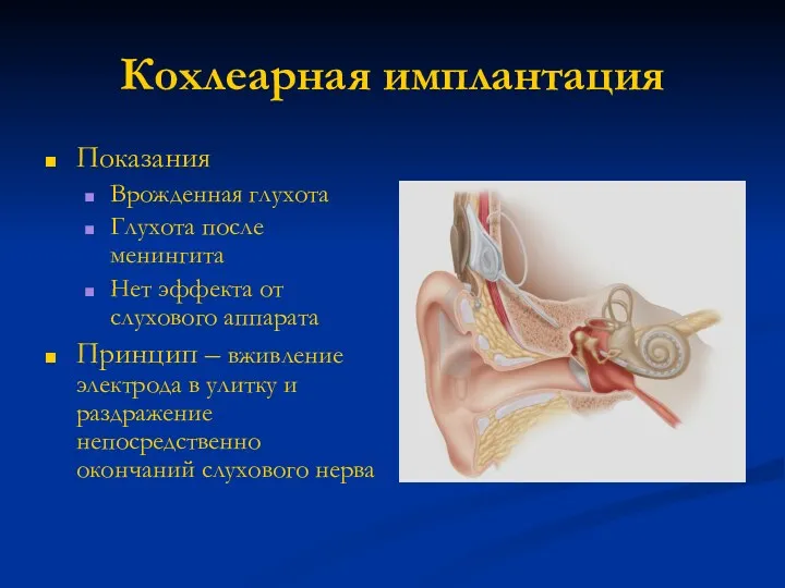 Кохлеарная имплантация Показания Врожденная глухота Глухота после менингита Нет эффекта