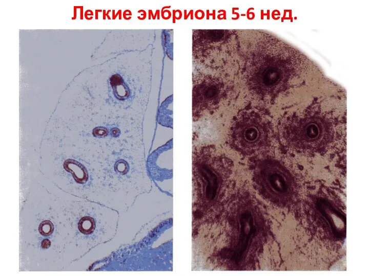 Легкие эмбриона 5-6 нед.