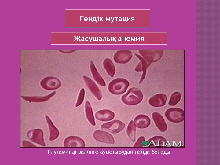 Гендік мутация Жасушалық анемия Глутаминді валинге ауыстырудан пайда болады