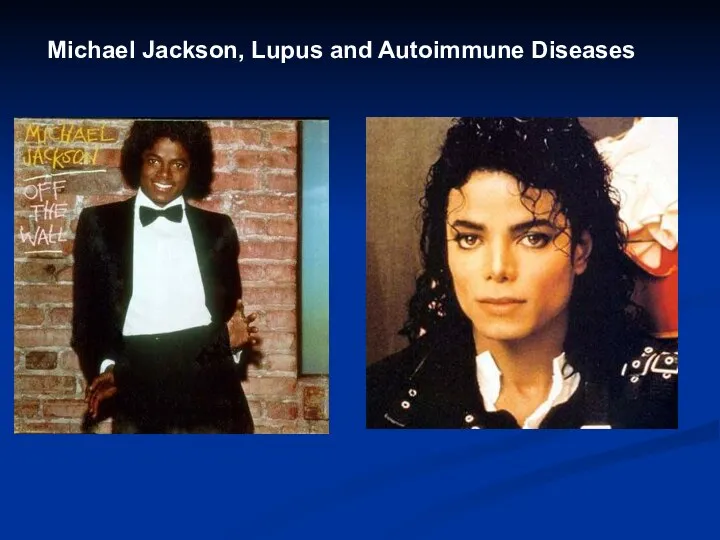 Michael Jackson, Lupus and Autoimmune Diseases