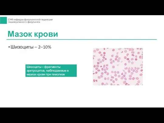 Шизоциты – 2–10% Мазок крови Шизоциты – фрагменты эритроцитов, наблюдаемые в мазках крови при гемолизе