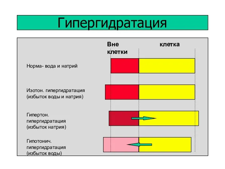 Гипергидратация Норма- вода и натрий Изотон. гипергидратация (избыток воды и натрия) Гипертон. гипергидратация