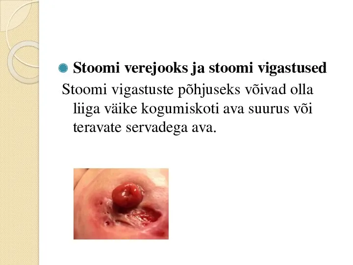 Stoomi verejooks ja stoomi vigastused Stoomi vigastuste põhjuseks võivad olla