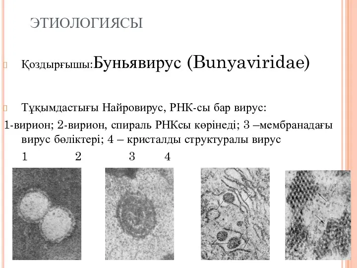 ЭТИОЛОГИЯСЫ Қоздырғышы:Буньявирус (Bunyaviridae) Тұқымдастығы Найровирус, РНК-сы бар вирус: 1-вирион; 2-вирион,