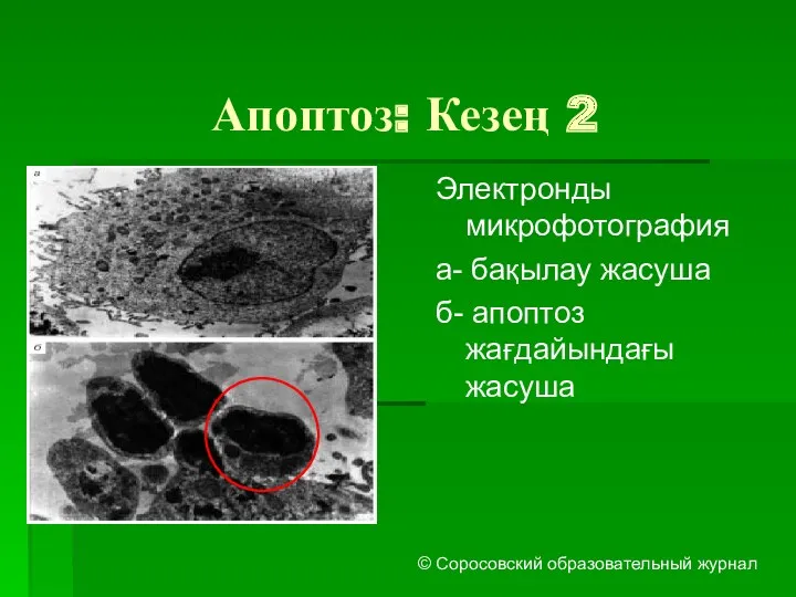 Апоптоз: Кезең 2 Электронды микрофотография а- бақылау жасуша б- апоптоз жағдайындағы жасуша © Соросовский образовательный журнал