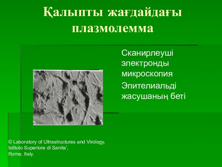 Қалыпты жағдайдағы плазмолемма Сканирлеуші электронды микроскопия Эпителиальді жасушаның беті ©