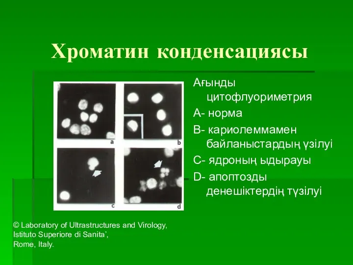 Хроматин конденсациясы Ағынды цитофлуориметрия A- норма B- кариолеммамен байланыстардың үзілуі