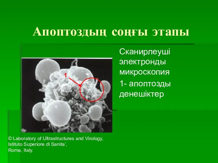 Апоптоздың соңғы этапы Сканирлеуші электронды микроскопия 1- апоптозды денешіктер 1