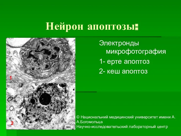Нейрон апоптозы: Электронды микрофотография 1- ерте апоптоз 2- кеш апоптоз