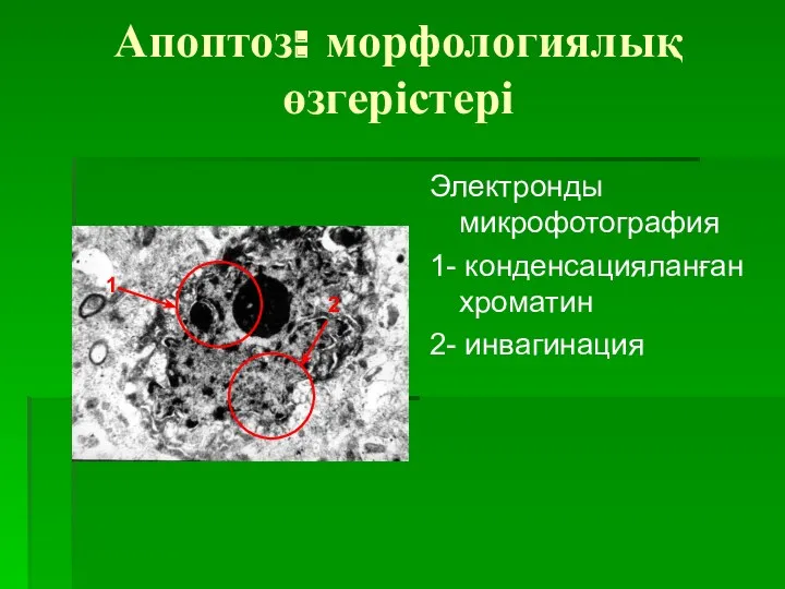 Апоптоз: морфологиялық өзгерістері Электронды микрофотография 1- конденсацияланған хроматин 2- инвагинация 2 1