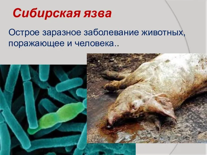 Сибирская язва Острое заразное заболевание животных, поражающее и человека..