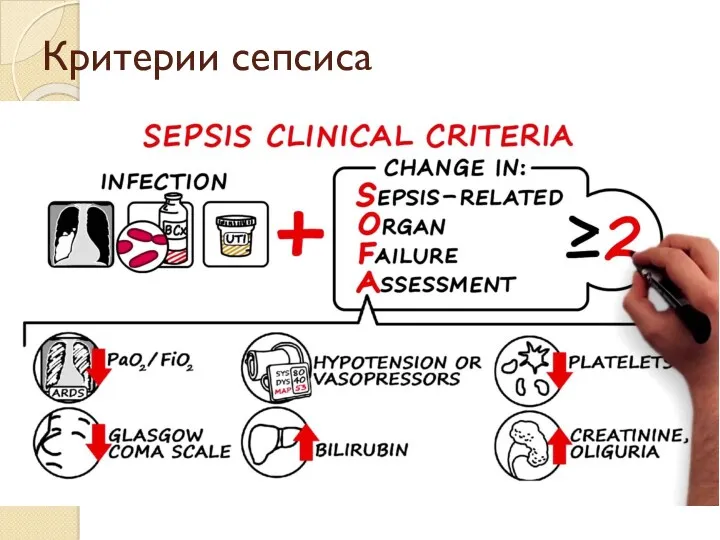 Критерии сепсиса Подозреваемая или документированная инфекция в сочетании с остро