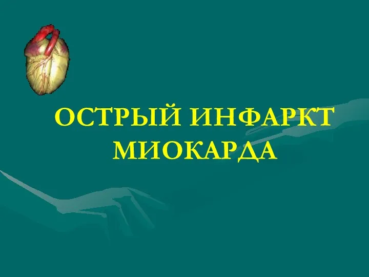 Острый инфаркт миокарда