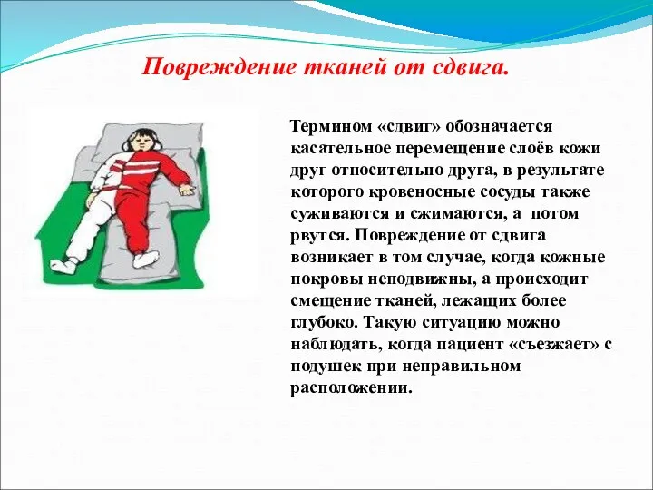 Повреждение тканей от сдвига. Термином «сдвиг» обозначается касательное перемещение слоёв