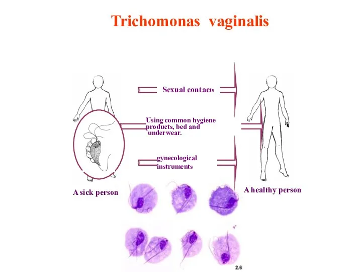 Trichomonas vaginalis A sick person A healthy person Sexual contacts