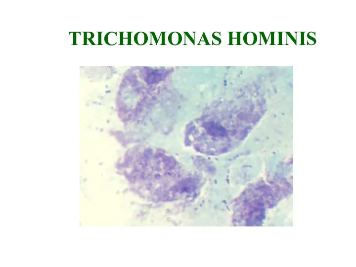 TRICHOMONAS HOMINIS