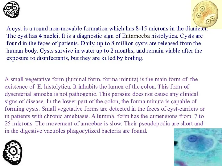 A cyst is a round non-movable formation which has 8-15