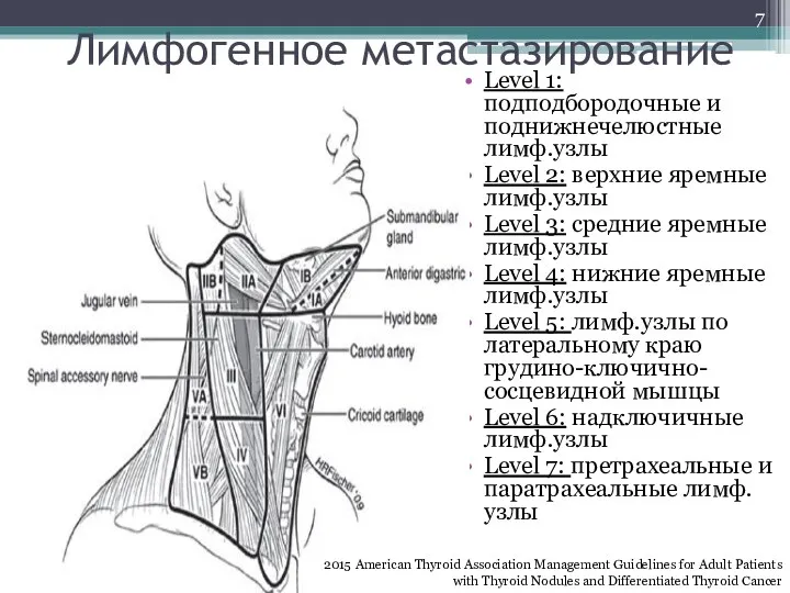 Лимфогенное метастазирование Level 1: подподбородочные и поднижнечелюстные лимф.узлы Level 2: