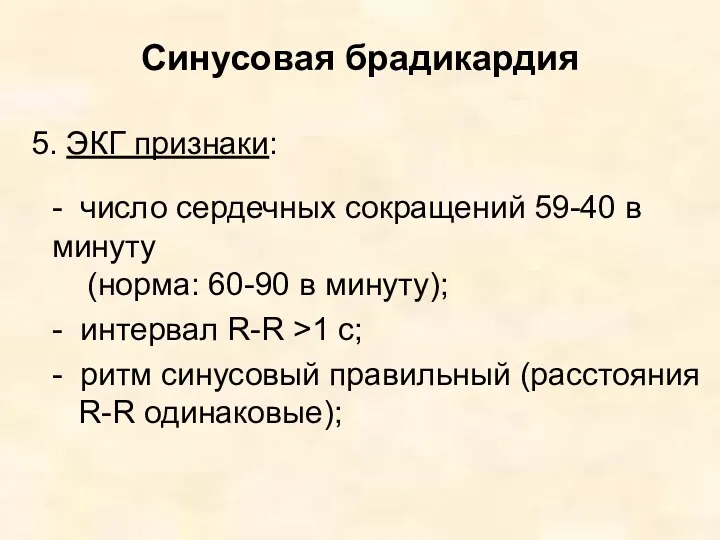 Синусовая брадикардия 5. ЭКГ признаки: - число сердечных сокращений 59-40