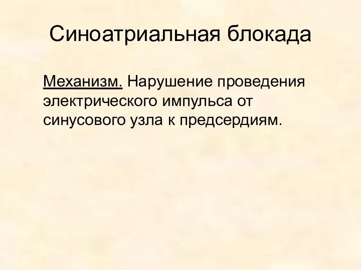 Синоатриальная блокада Механизм. Нарушение проведения электрического импульса от синусового узла к предсердиям.