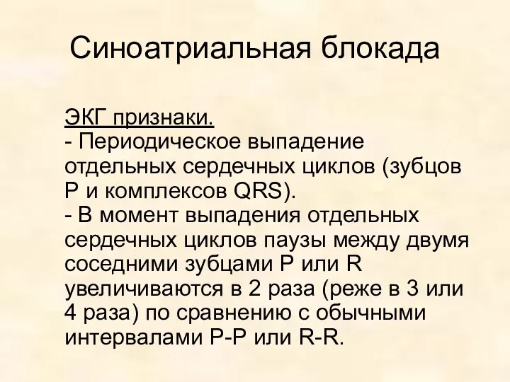 Синоатриальная блокада ЭКГ признаки. - Периодическое выпадение отдельных сердечных циклов