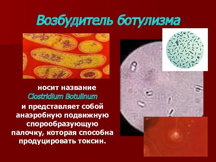 Возбудитель ботулизма носит название Clostridium Botulinum и представляет собой анаэробную подвижную спорообразующую палочку,