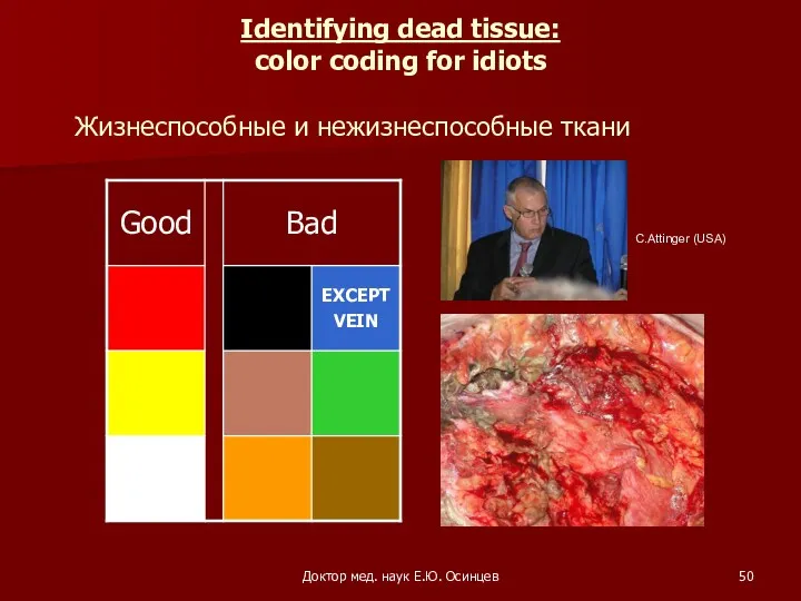 Доктор мед. наук Е.Ю. Осинцев Identifying dead tissue: color coding for idiots C.Attinger