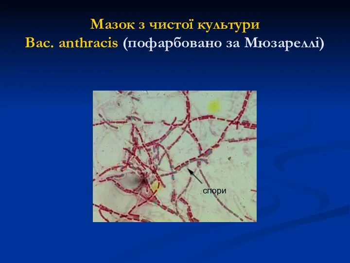 Мазок з чистої культури Вас. anthracis (пофарбовано за Мюзареллі) спори спори