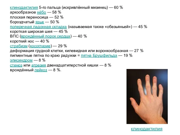 клинодактилия 5-го пальца (искривлённый мизинец) — 60 % аркообразное нёбо — 58 %