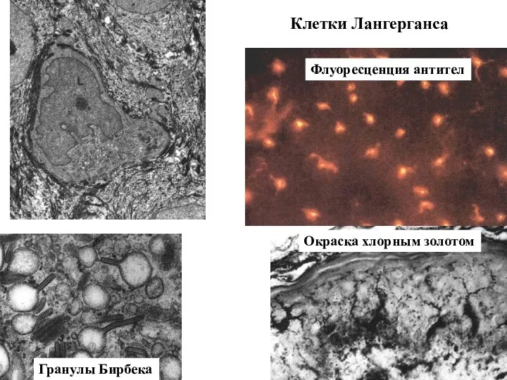 Гранулы Бирбека Клетки Лангерганса Флуоресценция антител Окраска хлорным золотом