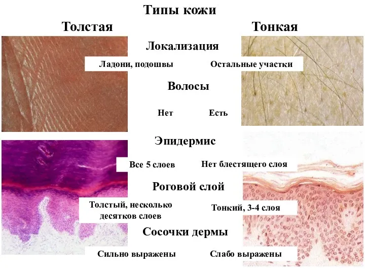 Типы кожи Толстая Тонкая Локализация Ладони, подошвы Остальные участки Эпидермис