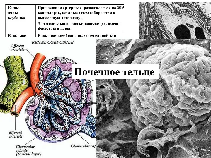 Почечное тельце