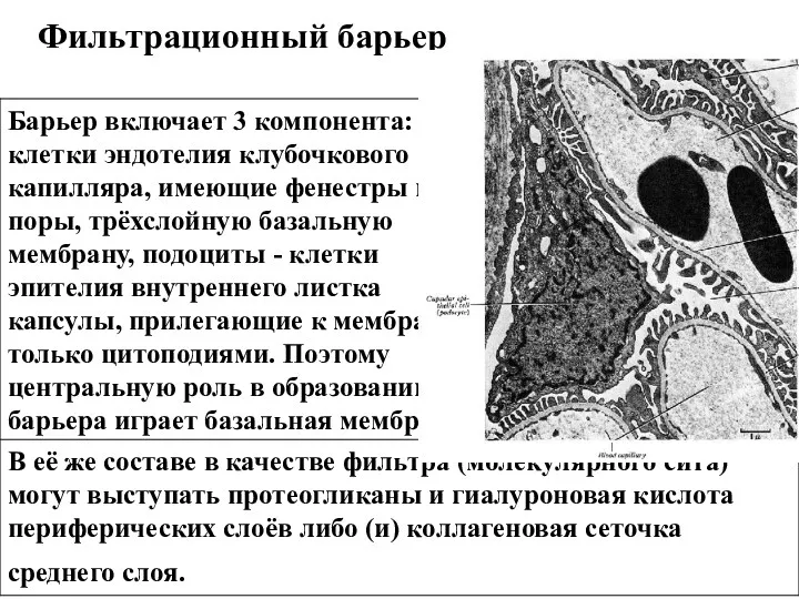 Фильтрационный барьер