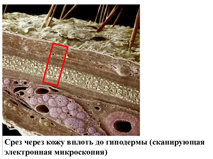 Срез через кожу вплоть до гиподермы (сканирующая электронная микроскопия)
