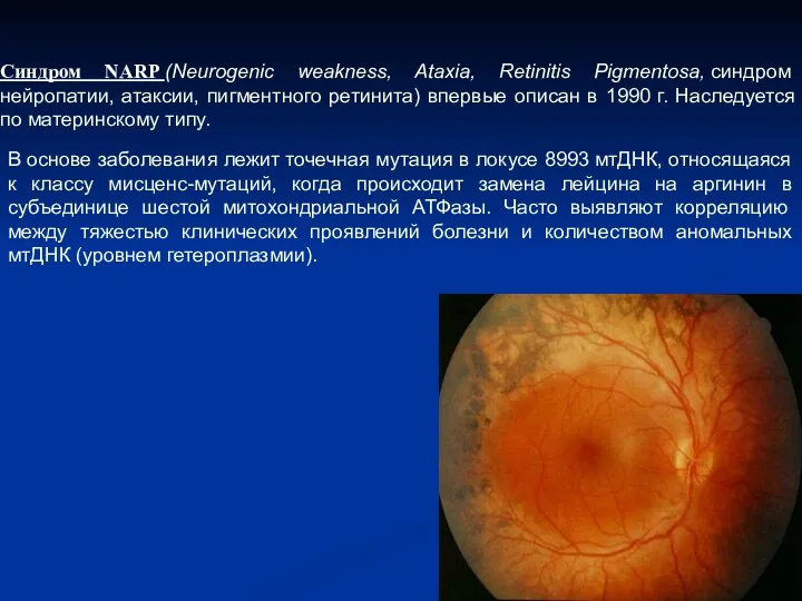 Синдром NARP (Neurogenic weakness, Ataxia, Retinitis Pigmentosa, синдром нейропатии, атаксии, пигментного ретинита) впервые