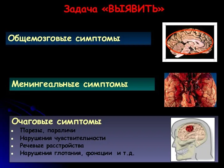 Очаговые симптомы Парезы, параличи Нарушения чувствительности Речевые расстройства Нарушения глотания,