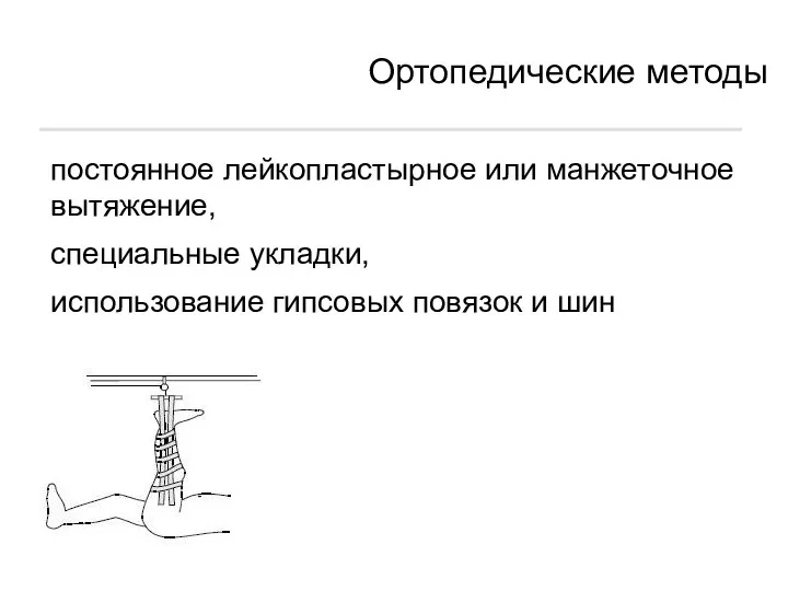 Ортопедические методы постоянное лейкопластырное или манжеточное вытяжение, специальные укладки, использование гипсовых повязок и шин