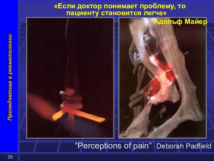 «Если доктор понимает проблему, то пациенту становится легче» Адольф Майер “Perceptions of pain” Deborah Padfield