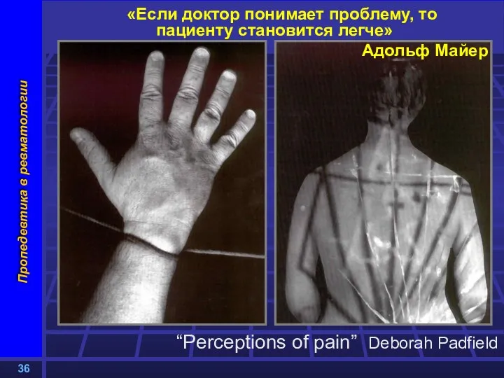 «Если доктор понимает проблему, то пациенту становится легче» Адольф Майер “Perceptions of pain” Deborah Padfield