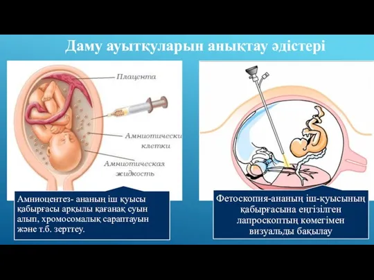 Даму ауытқуларын анықтау әдістері