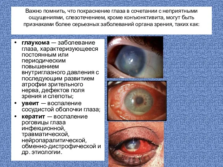 Важно помнить, что покраснение глаза в сочетании с неприятными ощущениями,