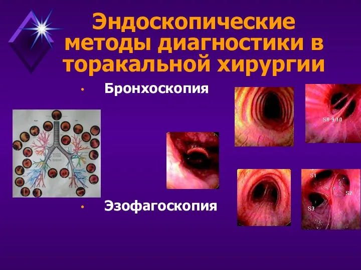 Эндоскопические методы диагностики в торакальной хирургии Бронхоскопия Эзофагоскопия