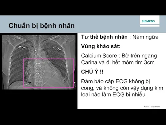 Tư thế bệnh nhân : Nằm ngữa Vùng khảo sát: Calcium Score :