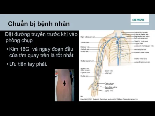 Đặt đường truyền trước khi vào phòng chụp Kim 18G và ngay đoạn