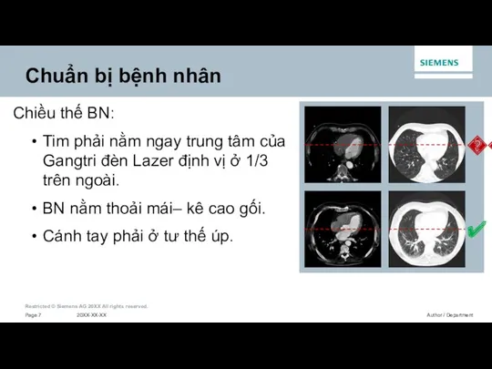 Chiều thế BN: Tim phải nằm ngay trung tâm của